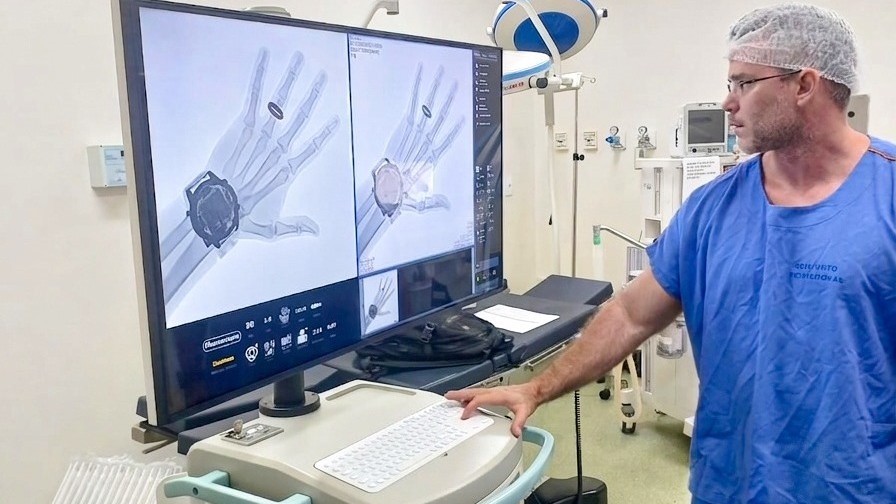 Médico ao lado do equipamento arco cirúrgico, que tem uma tela onde é mostrado o raio-x de um braço
